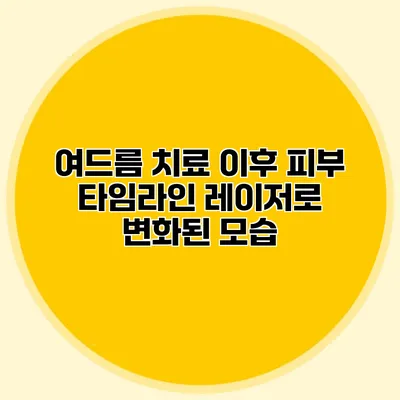 여드름 치료 이후 피부 타임라인 레이저로 변화된 모습